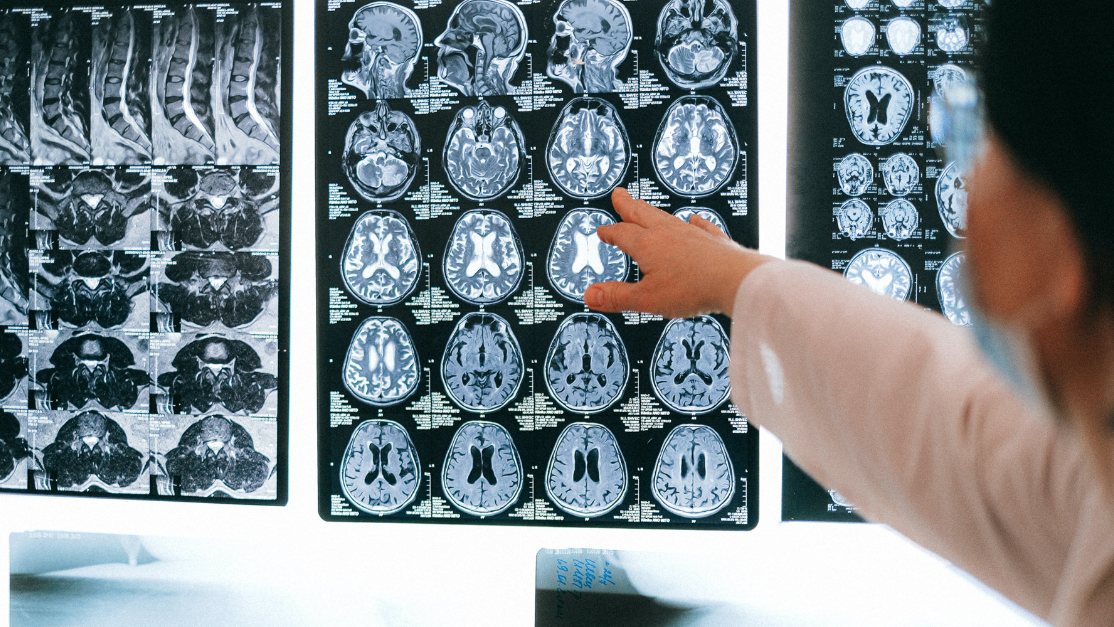 Doctor pointing on the screen with MRI film