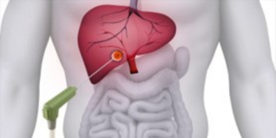 Illustration for liver and intestine
